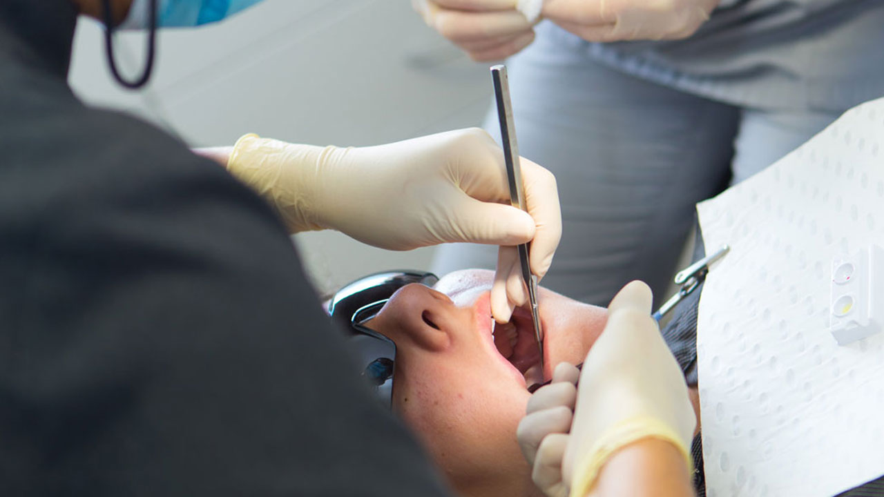 5bc7ea208494fce0179df300 wisdom tooth removal.webp
