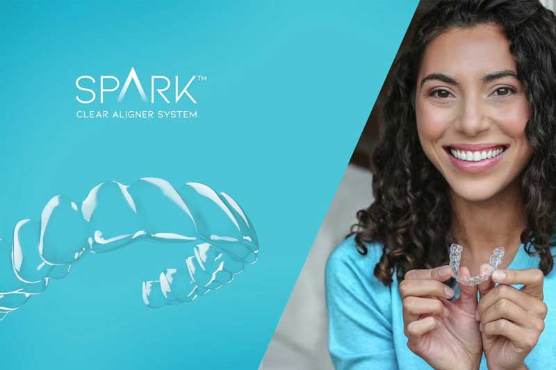 6811b71ac9585f180e9c3033 spark clear aligners