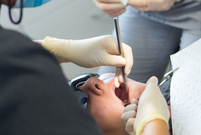 5bc7ea208494fce0179df300 wisdom tooth removal.webp